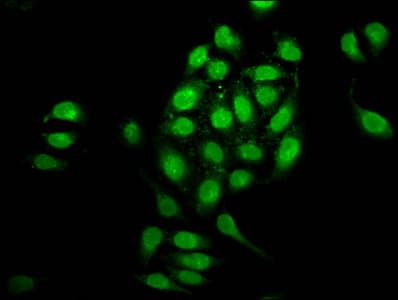 NUP98 Antibody