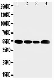 Polyclonal Rabbit anti-Human SLC16A4 Antibody (aa134-148, IHC, WB)