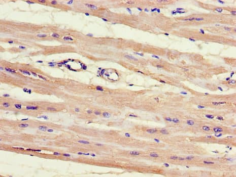 HnRNPLL / HNRPLL Antibody
