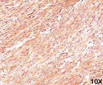 ANO1 / DOG1 / TMEM16A Antibody (clone DG1/447)