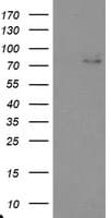EEYORE / TIGD1 Antibody (aa1-267, clone OTI3H4)