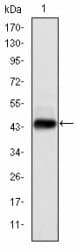 Monoclonal Mouse anti-Human Papillomavirus 16 HPV E7 Antibody (clone 2C11, IHC, WB)