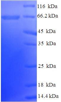 Human NPRB / NPR2 Protein (Recombinant His-SUMO)