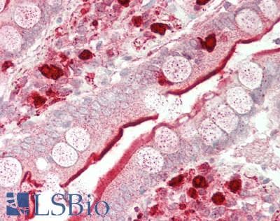 ACE / CD143 Antibody (aa814-1071)