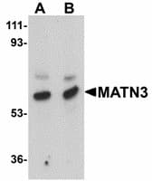Polyclonal Rabbit anti-Human MATN3 / Matrilin 3 Antibody (IF, WB)