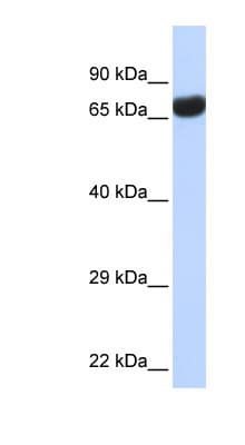 TPTE Antibody (aa396-445)