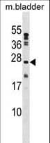 Polyclonal Rabbit anti-Human PTP4A1 / PRL-1 Antibody (aa140-168, WB)