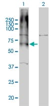 GABBR1 / GABA B Receptor 1 Antibody (clone 2D7)