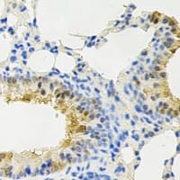 Polyclonal Rabbit anti-Human PPP4C Antibody (IHC, IF, WB)