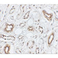AQP2 / Aquaporin 2 Antibody