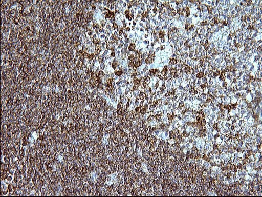 ICAM3 / CD50 Antibody (clone OTI1C2)