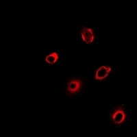 Polyclonal Rabbit anti-Human PCMT1 Antibody (IF, WB)