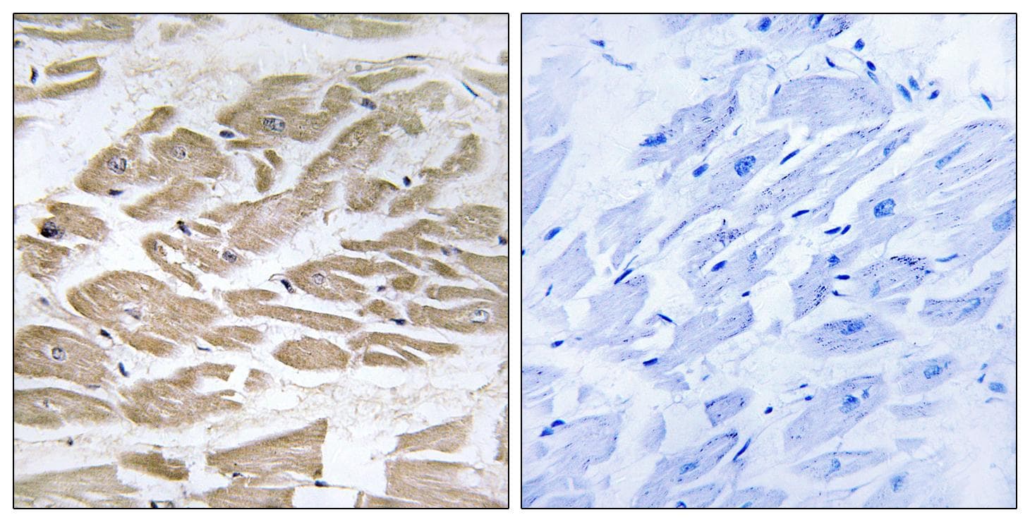 Polyclonal Rabbit anti-Human BRP44L Antibody (IHC, IF, WB)
