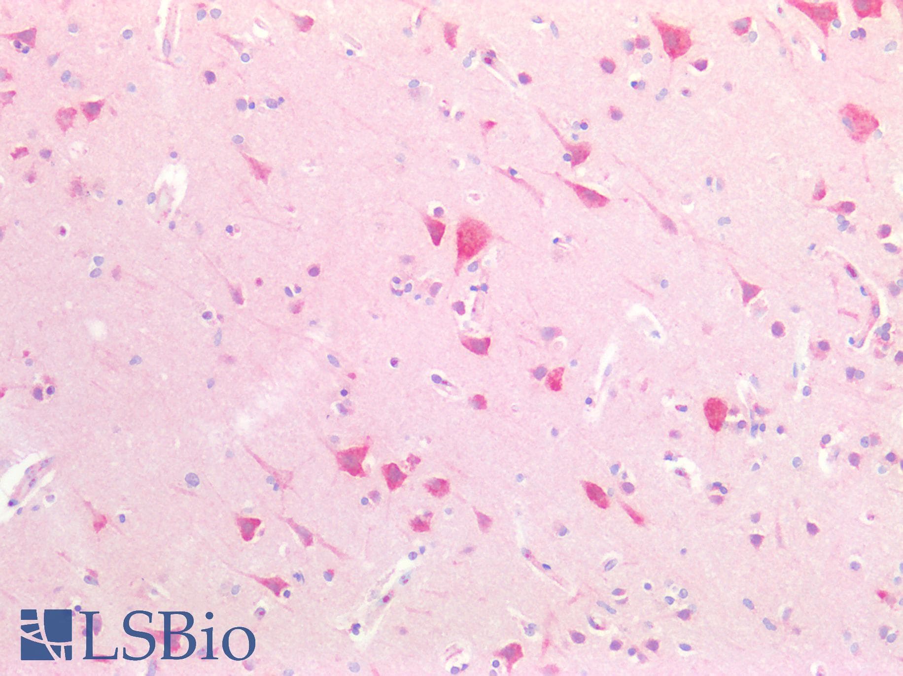 DRAK1 / STK17A Antibody