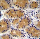 PLEKHG3 Antibody (aa1178-1207)