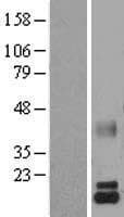 LALBA / Alpha Lactalbumin Protein (Over-Expression Lysate Myc-DDK (Flag))
