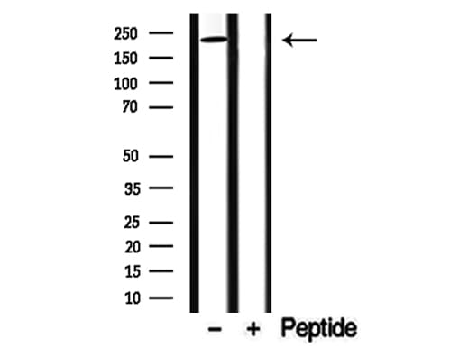 DENND4A Antibody