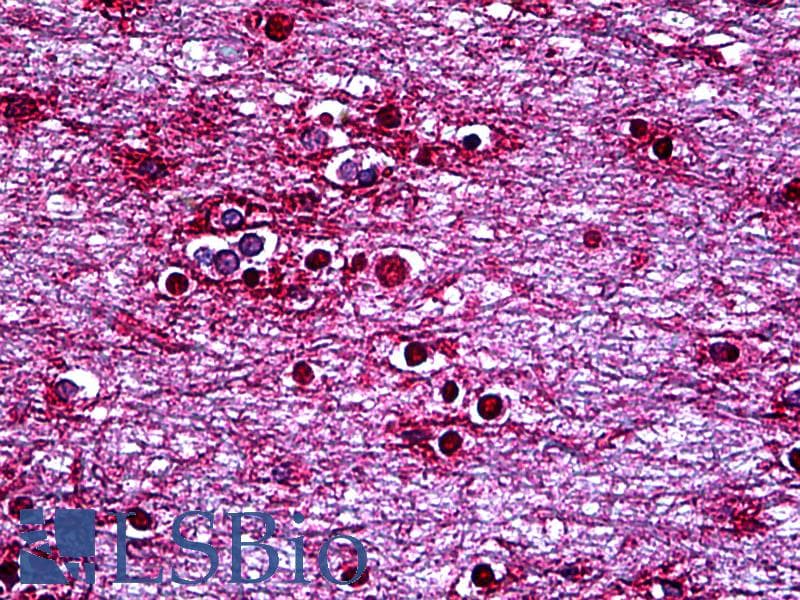 IHC-plus™ HMX2 Antibody (clone 1B10)