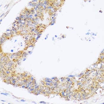 ZAK / MLTK Antibody