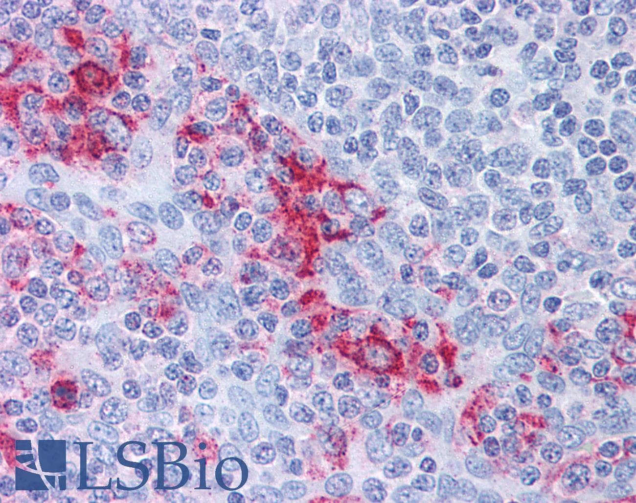 IHC-plus™ Polyclonal Rabbit anti-Mouse CTSE / Cathepsin E Antibody (C-Terminus, IHC, WB)