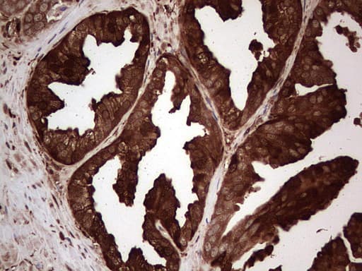 LGALS3 / Galectin 3 Antibody (clone OTI2F1)
