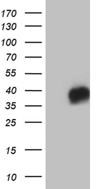 CD79B / CD79 Beta Antibody (clone OTI9H8, Carrier-free)