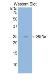 GCLC Antibody (aa435-636, PE)