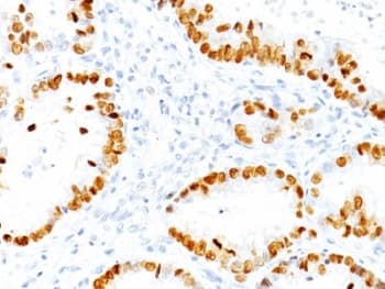 NKX2-1 / Thyroid-Specific TF Antibody (clone NX2.1/690)