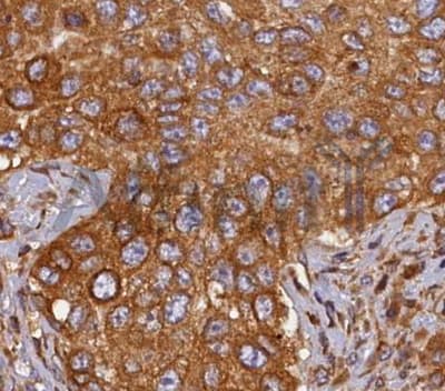 HMOX2 / Heme Oxygenase 2 Antibody