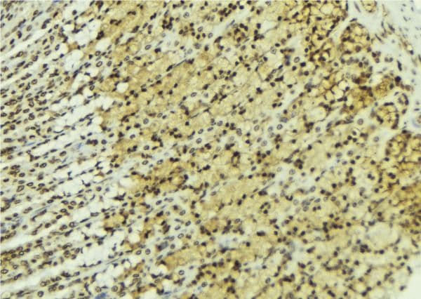 SIAH1 Antibody