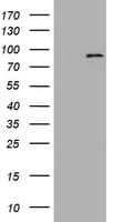 NBN / Nibrin Antibody (clone OTI3A2)