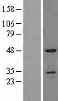 USAG1 / SOSTDC1 Protein (Over-Expression Lysate Myc-DDK (Flag))