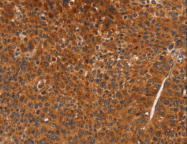 CDK19 / CDK11 Antibody
