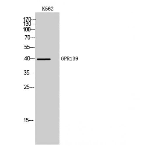 GPR139 Antibody (150-230 aa, Internal)