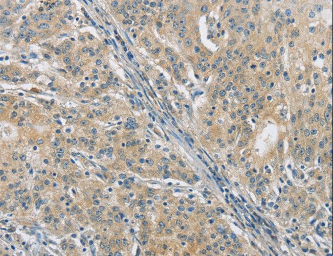 PKD1 / Polycystin Antibody (aa3725-3735)