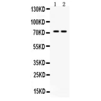 MDM4 / MDMX Antibody (aa35-72)