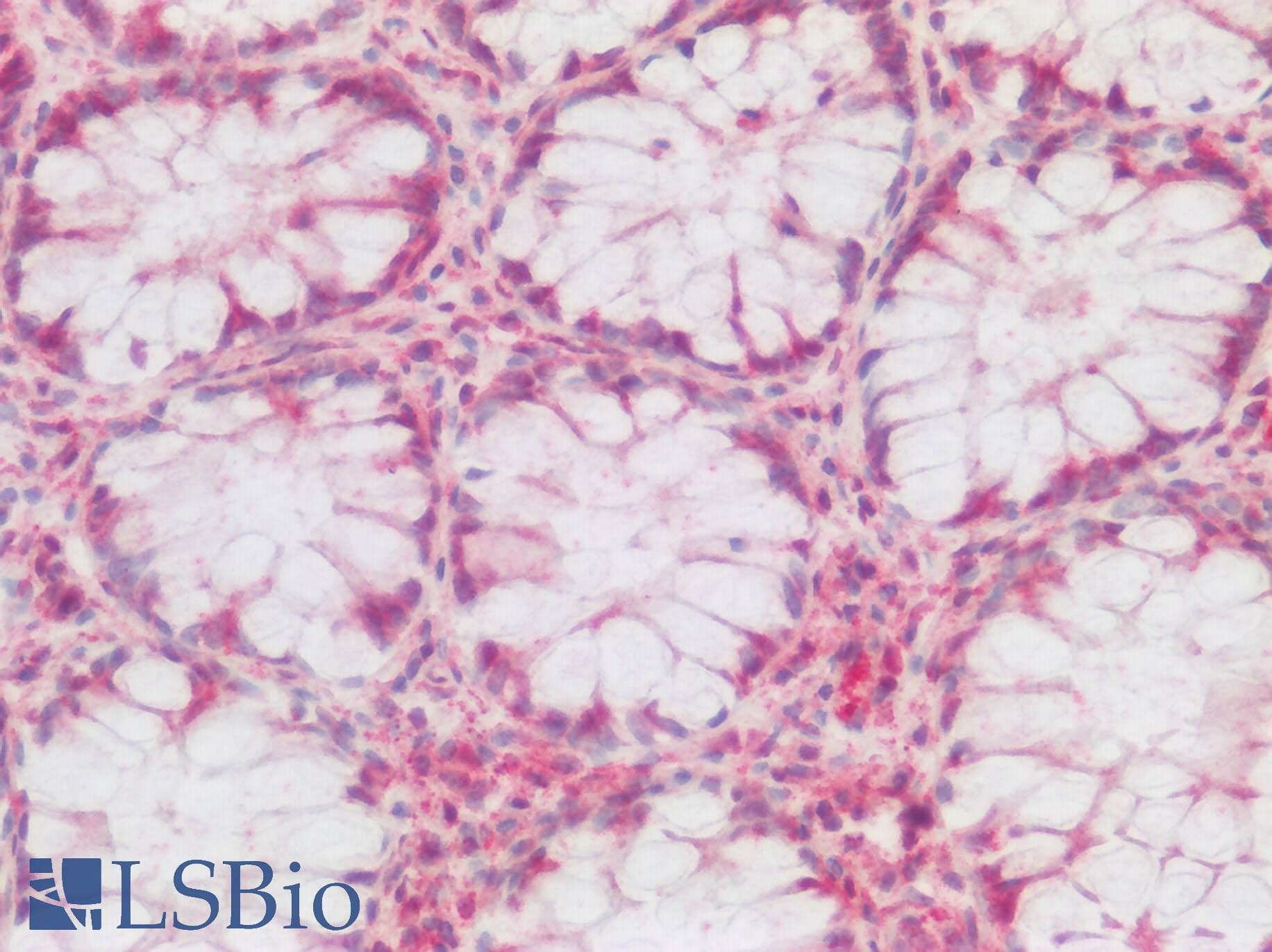 IHC-plus™ Polyclonal Rabbit anti-Human HTR1F / 5-HT1F Receptor Antibody (N-Terminus, IHC)