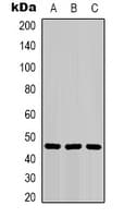 IHC-plus™ Monoclonal Mouse anti-Human KRT18 / CK18 / Cytokeratin 18 Antibody (IHC, WB)