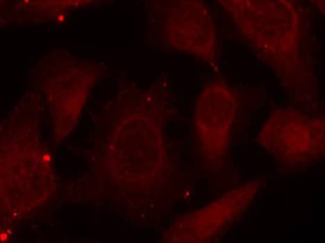 Polyclonal Rabbit anti-Human NF2 / Merlin Antibody (phospho-Ser518, IF, WB)
