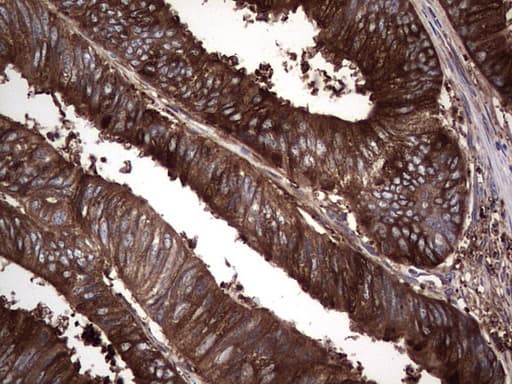 GARS / Glycyl tRNA Synthetase Antibody (clone OTI4G4)