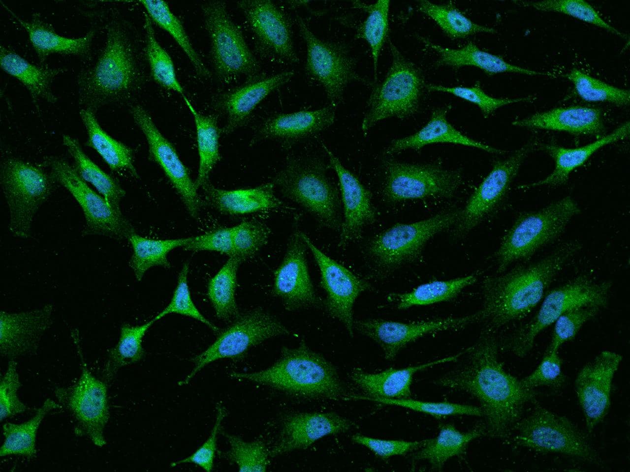 SNCB / Beta-Synuclein Antibody