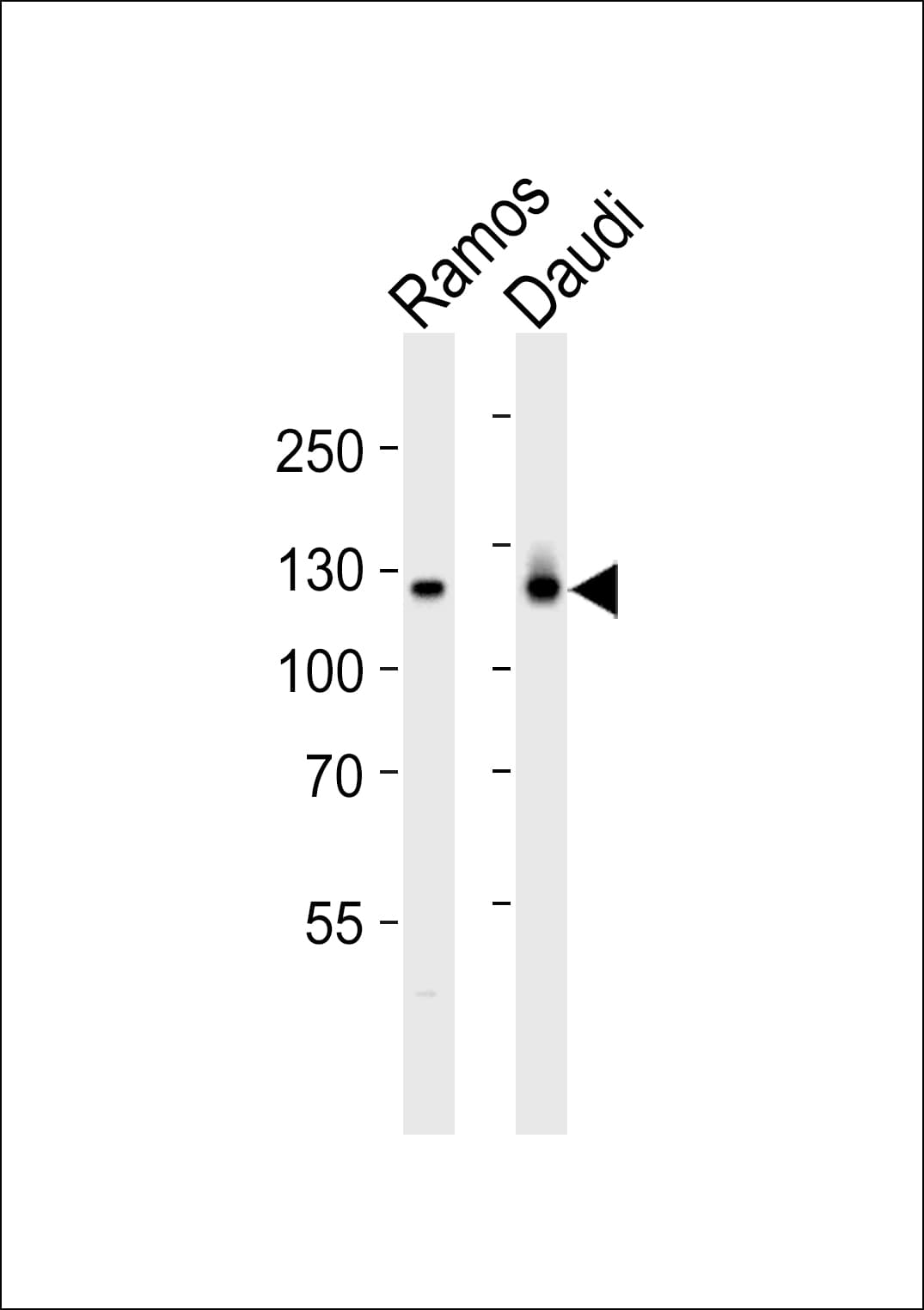 PTK2B / PYK2 Antibody (aa805-838)