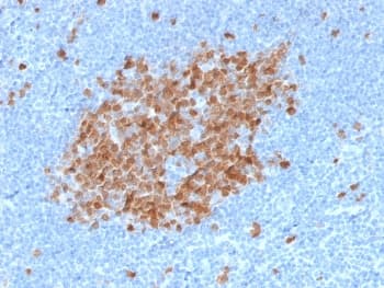 Monoclonal Mouse anti-Human thyA / Thymidylate Synthetase Antibody (clone TYMS/1884, Azide-free,BSA-free, IHC)