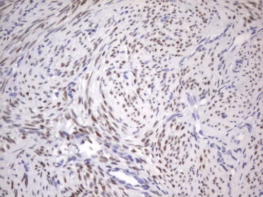 ER Alpha / Estrogen Receptor Antibody (aa1-310, clone OTI2D3)
