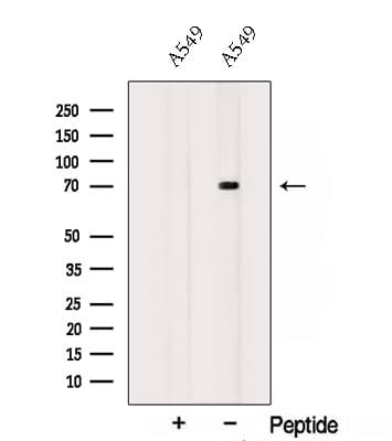 Polyclonal Rabbit anti-Human SOX5 Antibody (WB)