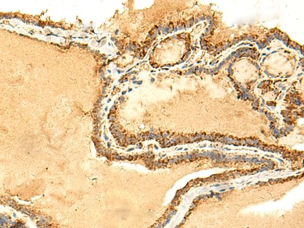 Polyclonal Rabbit anti-Human ATP5H Antibody (IHC, WB)