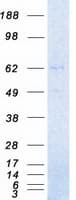 Human IRAK3 / IRAKM / IRAK-M Protein (Recombinant Myc-DDK (Flag))