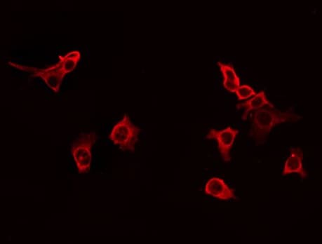 GPRIN1 / GRIN1 Antibody