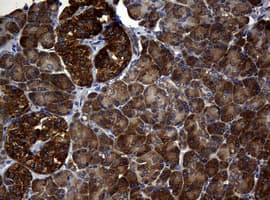 NME1 / NM23 Antibody (clone OTI2D8)