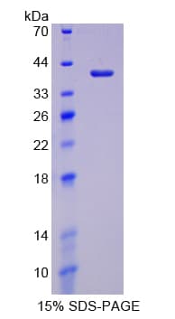 Rat LDHC / Lactate Dehydrogenase C Protein (Recombinant His-T7)